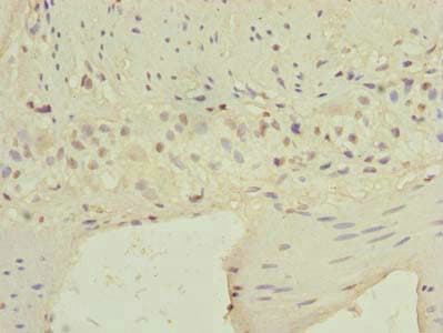 C9orf89 Antibody