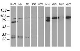 CTNNB1 / Beta Catenin Antibody (clone OTI9F6)