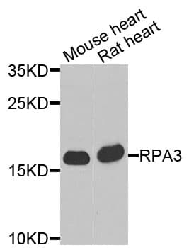 Polyclonal Rabbit anti-Human RPA3 Antibody (IHC, WB)