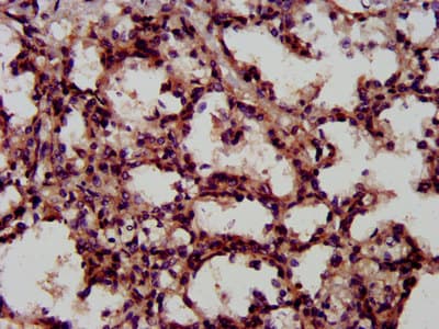 CD118 / LIF Receptor Alpha Antibody