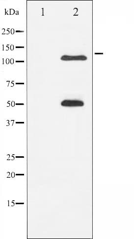 NFKB1 / NF-Kappa-B Antibody (phospho-Ser337)