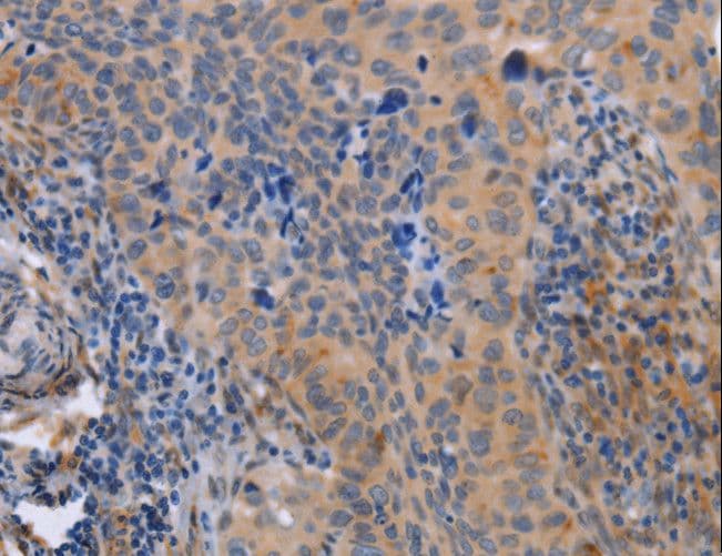 MAP3K13 / LZK Antibody