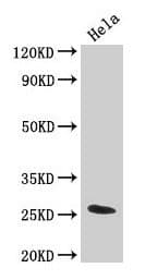 IHC-plus™ Polyclonal Rabbit anti-Human TNF Alpha Antibody (aa77-233, IHC, WB)
