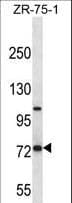 FOLH1 / PSMA Antibody (aa161-190)