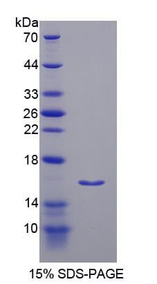 Rat Irs3 Protein (Recombinant His-S)