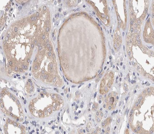 PLA2G4A Antibody (phospho-Ser505)