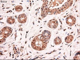 MYC / c-Myc Antibody (clone OTI3F2)