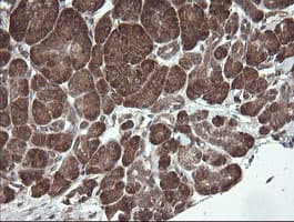Monoclonal Mouse anti-Human UBE2J1 Antibody (clone OTI3C11, IHC, WB)