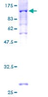 Human PEX5 Protein (Recombinant GST)