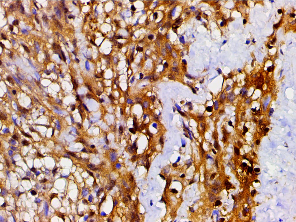 CFL1 / Cofilin Antibody (phospho-Ser3)