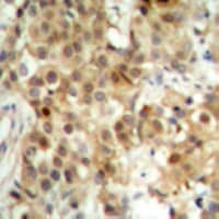 RELA / NFKB p65 Antibody (Internal)