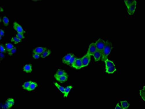 Polyclonal Rabbit anti-Human AAK1 Antibody (IHC, IF, WB)