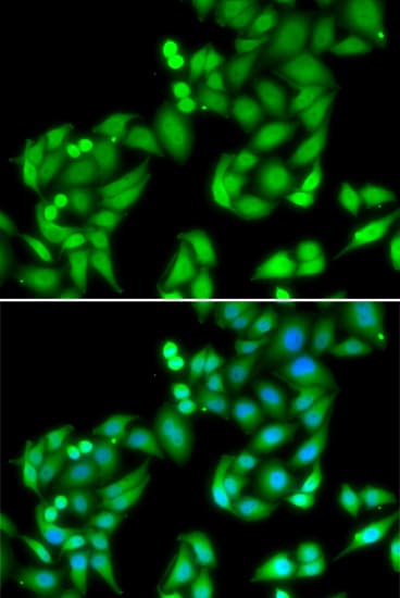 Polyclonal Rabbit anti-Human COPS3 / CSN3 Antibody (IHC, IF, WB)
