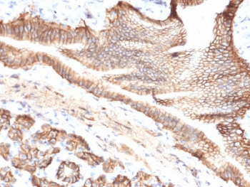 TROP2 / TACSTD2 Antibody (clone TACSTD2/2151)
