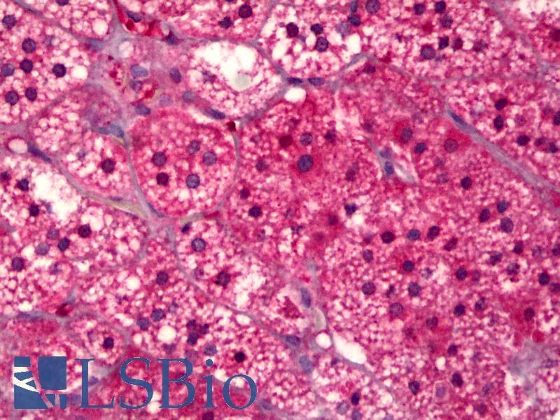 IHC-plus™ SUCNR1 / GPR91 Antibody (aa100-149)