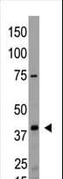 LPAR2 / EDG4 Antibody (aa3-32)