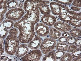 Monoclonal Mouse anti-Human TRIM44 Antibody (clone OTI1E10, IHC, IF, WB)