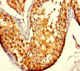 ADCK2 Antibody
