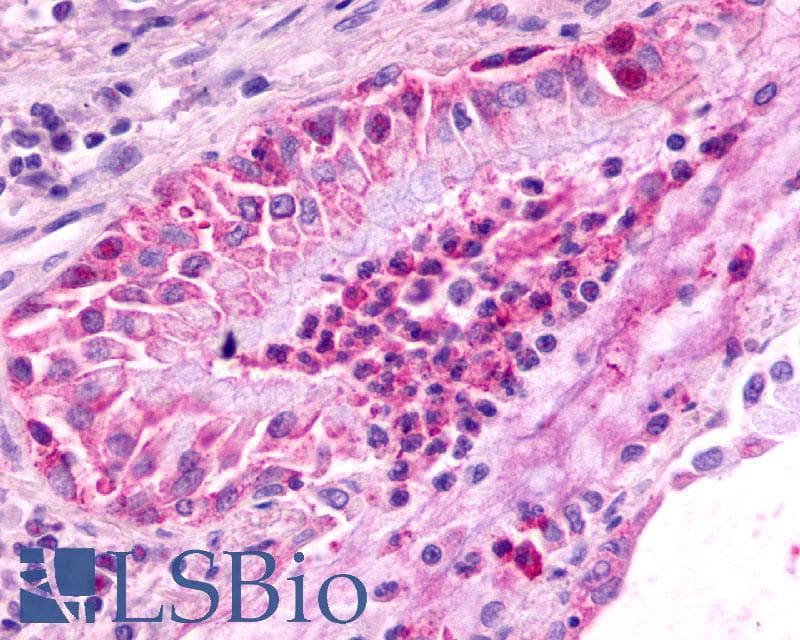 PathPlus™ Polyclonal Rabbit anti-Human CXCR2 Antibody (Extracellular Domain, IHC)