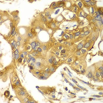 Polyclonal Rabbit anti-Human CAPNS1 / CAPN4 Antibody (IHC, WB)
