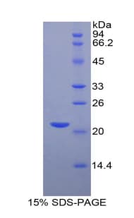 Rat HIF1A / HIF1 Alpha Protein (Recombinant His)