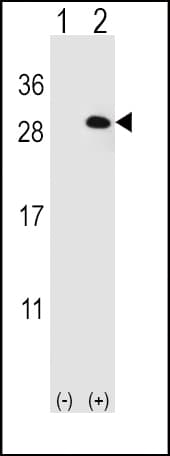 EIF4E2 / IF4e Antibody