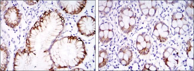 CA9 / Carbonic Anhydrase IX Antibody (clone 2D3)