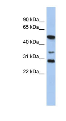 Polyclonal Rabbit anti-Human SOX3 Antibody (aa215-264, WB)