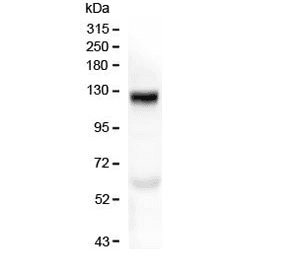 Polyclonal Rabbit anti-Human COL17A1 / Collagen XVII Antibody (WB)