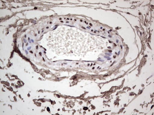 Monoclonal Mouse anti-Human SAE1 Antibody (clone OTI6B11, IHC, WB)