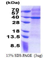 Human MRPS2 Protein (Recombinant His)