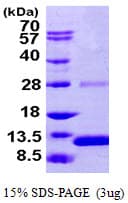 Human S100A2 Protein (Recombinant His)