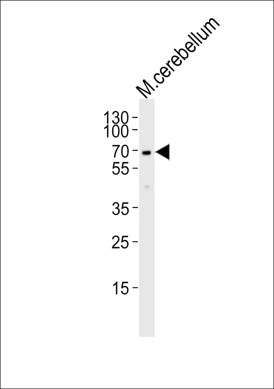 MTF2 / PCL2 Antibody (aa289-317)