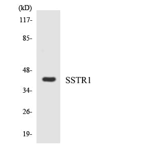 Polyclonal Rabbit anti-Human SSTR1 Antibody (aa48-97, WB)