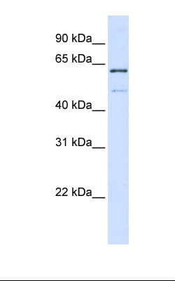 Polyclonal Rabbit anti-Human METTL16 / METT10D Antibody (aa38-87, WB)