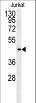 Polyclonal Rabbit anti-Human FFAR3 / GPR41 Antibody (aa293-322, WB)
