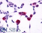 PathPlus™ GPR4 Antibody (C-Terminus)