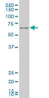 FOXO1 / FKHR Antibody (clone 4A10)