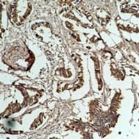 HSPB1 / HSP27 Antibody
