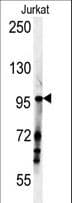 Polyclonal Rabbit anti-Human SPAG1 / TPIS Antibody (aa124-152, IHC, WB)