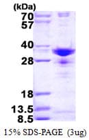 Human SNRPA1 Protein (Recombinant His)