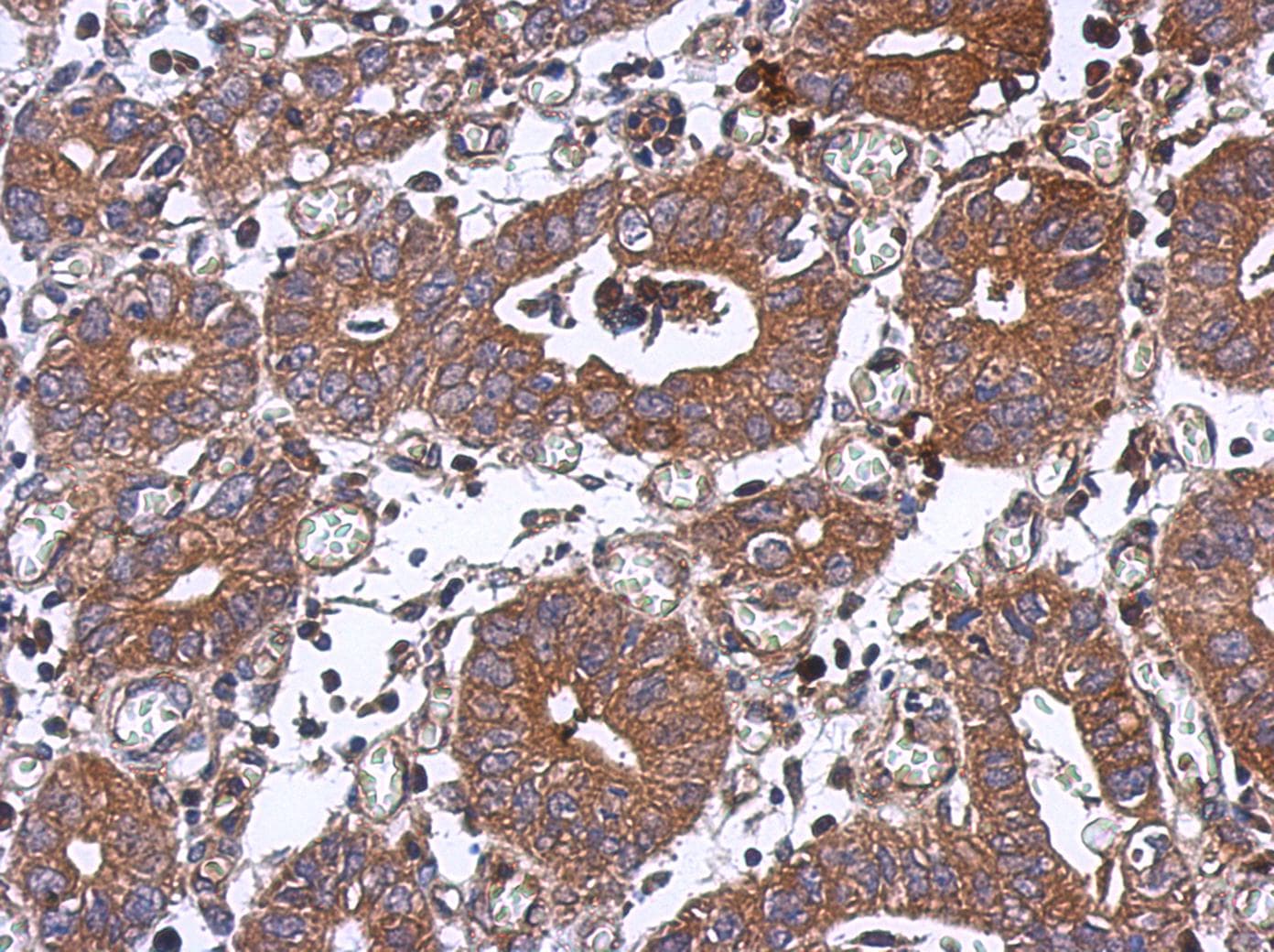 PPM1J Antibody