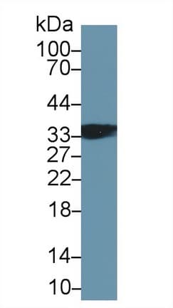 TNNT1 / TNT Antibody (aa1-278, APC)