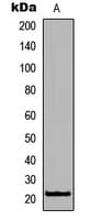 Polyclonal Rabbit anti-Human RHOXF1 Antibody (C-Terminus, WB)
