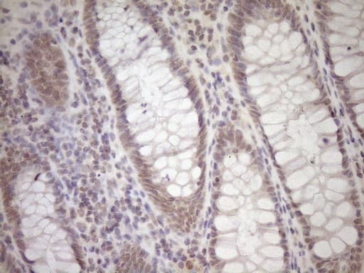 LAMB2 / Laminin Beta 2 Antibody (aa314-561, clone OTI3B4)
