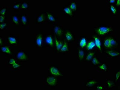 Polyclonal Rabbit anti-Human TNRC6A / GW182 Antibody