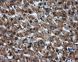 Monoclonal Mouse anti-Human BRAF / B-Raf Antibody (clone OTI1E2, IHC, IF, WB)