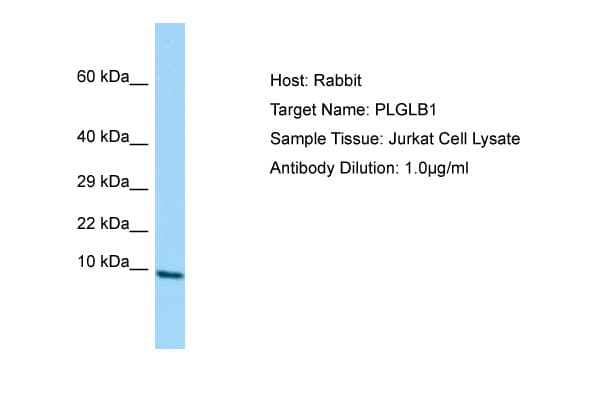 Polyclonal Rabbit anti-Human PLGLB2 / PLGLB1 Antibody (aa38-87, WB)
