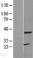 KCMF1 Protein (Over-Expression Lysate Myc-DDK (Flag))