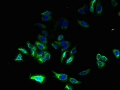 Polyclonal Rabbit anti-Human C17orf62 Antibody (IHC, WB)